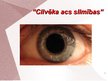 Презентация 'Cilvēka acu un redzes slimības', 1.