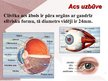 Презентация 'Cilvēka acu un redzes slimības', 2.