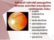 Презентация 'Cilvēka acu un redzes slimības', 4.