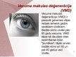 Презентация 'Cilvēka acu un redzes slimības', 5.