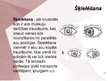 Презентация 'Cilvēka acu un redzes slimības', 17.