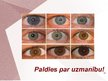 Презентация 'Cilvēka acu un redzes slimības', 19.