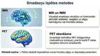 Презентация 'P viela kā neiromediators un neiropeptīds', 19.