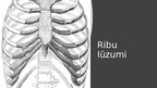 Презентация 'Iegurņa kaula lūzumi, iegurņa stabilizācijas tehnikas. Krūšu kurvja, krūšu kaula', 15.