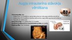 Презентация 'Cukura un gestācijas diabēts grūtniecības laikā', 6.