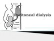 Презентация 'Peritoneal Dialysis', 1.