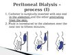 Презентация 'Peritoneal Dialysis', 5.