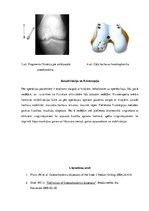 Реферат 'Osteohondritis dissecans jeb atslāņojošais osteohondrīts', 5.