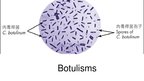 Презентация 'Ūdens piesārņojums - botulisma nūjiņa', 1.