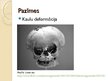 Презентация 'Trauslo kaulu sindroms', 6.