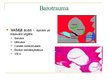 Презентация 'Barotrauma', 13.