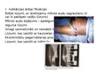 Презентация 'Kustību un balsta aparāta traumu konservatīvās un ķirurģiskās ārstēšanas metodes', 29.