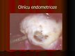 Презентация 'Endometrioze', 11.