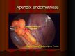 Презентация 'Endometrioze', 14.
