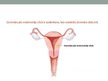 Презентация 'Dzemdes ķermeņa jeb endometrija vēzis', 2.