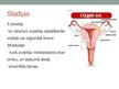 Презентация 'Dzemdes ķermeņa jeb endometrija vēzis', 10.