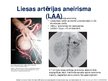 Презентация 'Viscerālo artēriju aneirismas', 2.