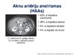 Презентация 'Viscerālo artēriju aneirismas', 6.