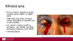 Презентация 'Ebolas vīrusslimība jeb Ebolas hemorāģiskais drudzis', 10.