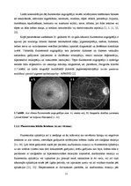 Дипломная 'Lielmolekulārā un mazmolekulārā fluoresceīna pielietojamības salīdzinājums optom', 16.