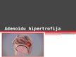 Презентация 'Adenoīdu hipertrofija', 1.