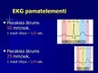 Презентация 'EKG pamati, dzīvībai bīstamie ritmi', 9.