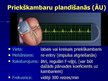Презентация 'EKG pamati, dzīvībai bīstamie ritmi', 38.