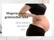 Презентация 'Muguras sāpes grūtniecības laikā un pēcdzemdību periodā', 1.