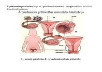 Конспект 'Ektopiskas grūtniecības anatomiska lokalizācija', 2.