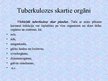 Презентация 'Tuberkuloze', 4.