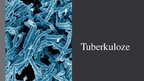 Презентация 'Tuberkuloze', 1.