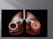 Презентация 'Astma', 7.