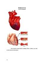 Реферат 'Koronārās sirds slimības un to riska faktori', 32.