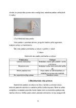 Реферат 'Roku protēzes', 12.