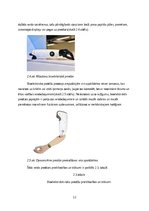 Реферат 'Roku protēzes', 13.