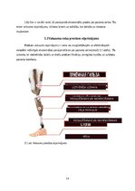 Реферат 'Roku protēzes', 15.