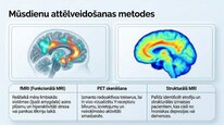 Презентация 'Neiropeptīds Y un galvenie neiromediatori', 20.