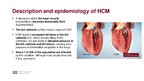 Презентация 'Hypertrophic Cardiomyopathy', 3.