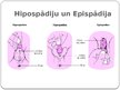 Презентация 'Hipospādija un epispādija', 24.