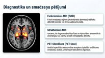 Презентация 'Vazopresīns', 21.