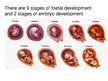 Презентация 'Foetal Development', 3.