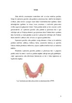 Реферат 'Bāzu plastmasas, to veidi un pielietojums izņemamo parciālo zobu protēžu ar plas', 4.